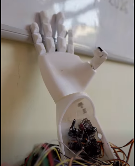Prosthetic hand
